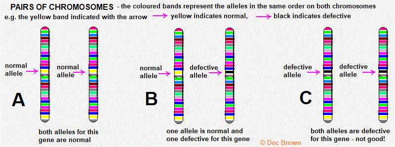 cystic fibrosis diagram of chromosome genes with normal pair of alleles defective alleles gcse biology igcse